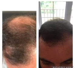 René Furterer RENÉ FURTERER - Trio Perte De Cheveux Progressive - Cure 3 Mois -Beauté Soins Boutique promo trio perte de cheveux progressive cure 3 mois rene furterer 355516